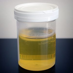 Qué significa soñar con orines